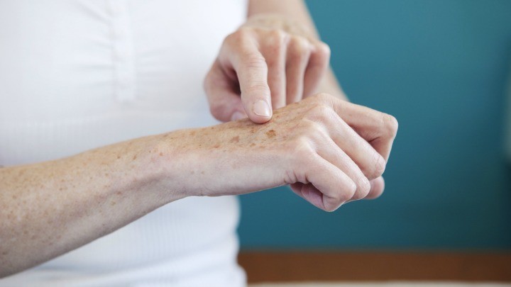031215_HandSkin