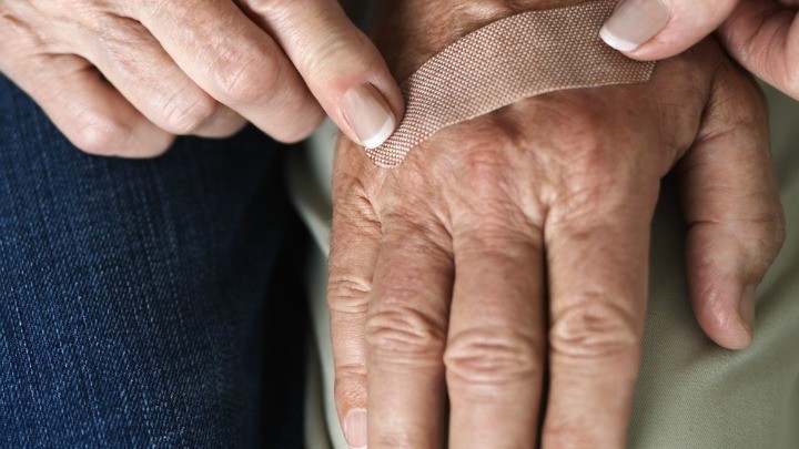 150216_hand_skin_tear