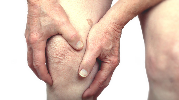 201115_osteo_legs