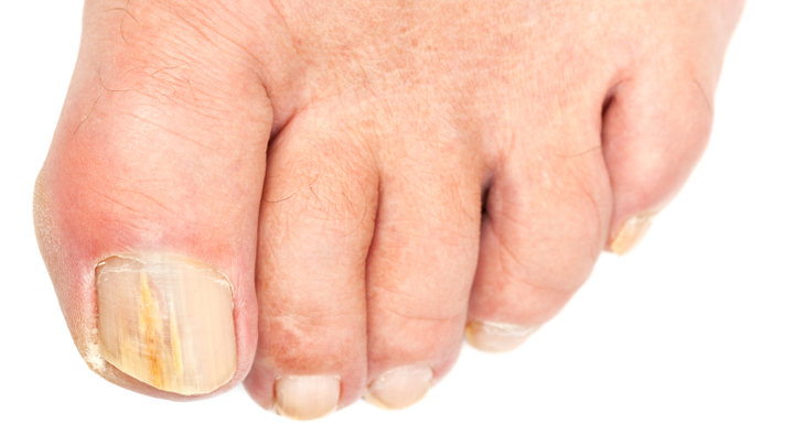 10-top-tips-for-ageing-toenails-starts-at-60