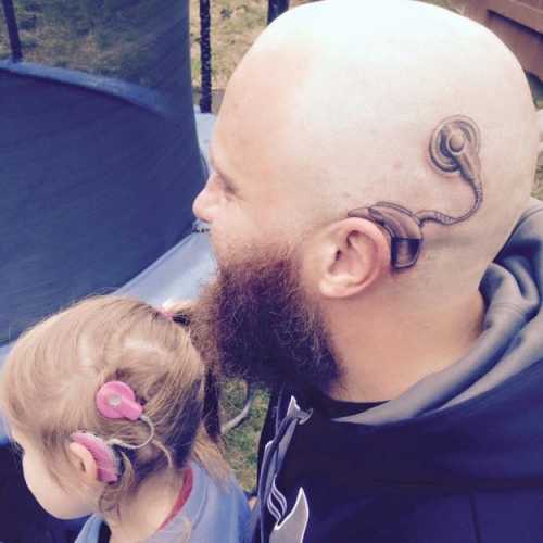 cochlear implant dad