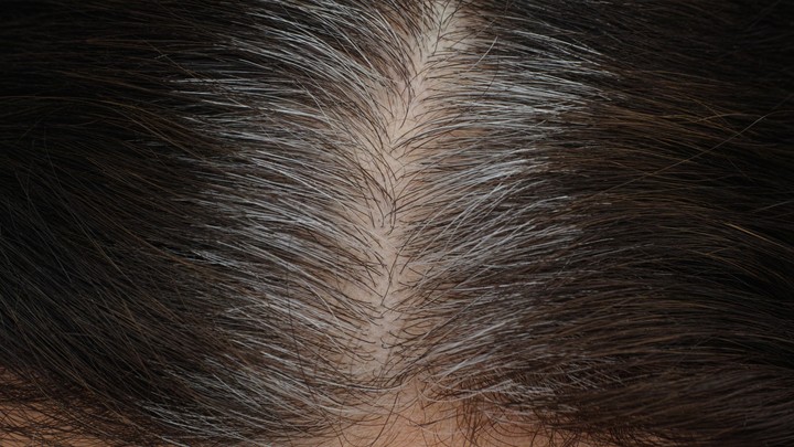 180316_grey_roots