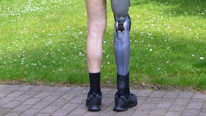 250516_prosthetic_legs