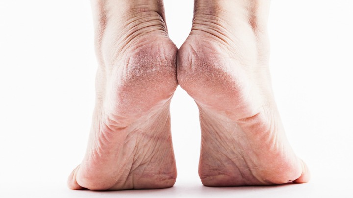 160628_Feet_720x405