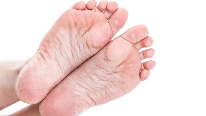 Treat The Most Common Foot Problems Simply And Naturally Starts At 60