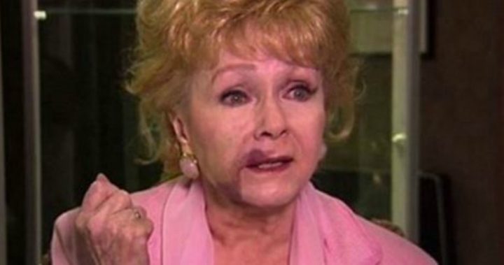 The huge bruise on Debbie Reynolds' face. Photo: HBO Documentaries.