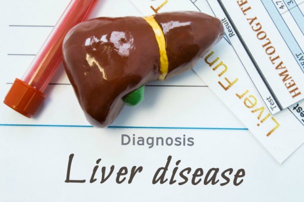 Preventing liver disease starts with a healthy diet.