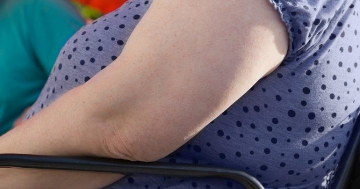 1790320womanarm