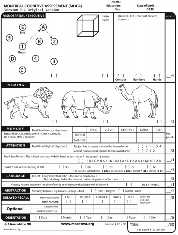 Can you beat Trump's cognitive test | Starts at 60