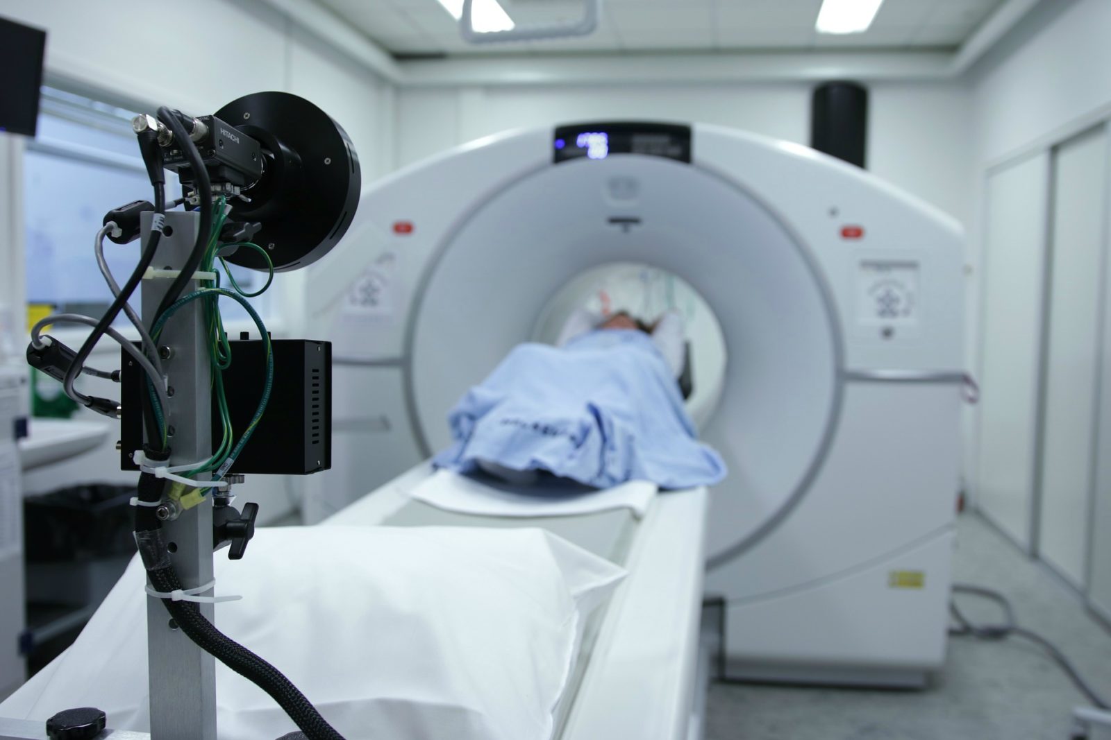 An x-ray or CT scan is often used to detect if someone has lung cancer. 